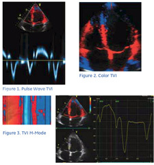 left_ventricular_function.jpg