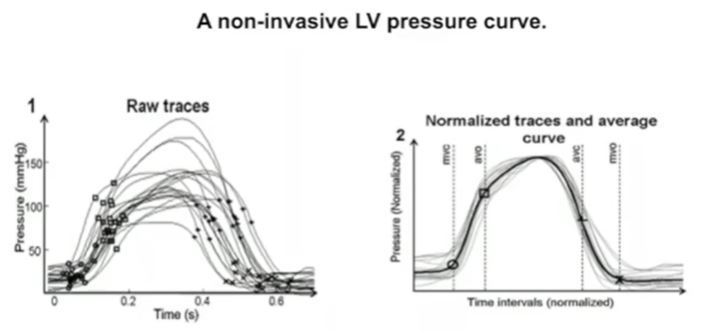lv-curve-vic.JPG