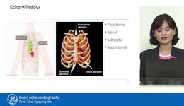 1. Basic echocardiography  