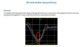 Vivid E95, E90 and EchoPAC: AFI and Cardiac Dyssynchrony 