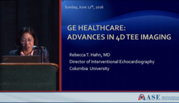 GE Symposium 2016: Advances in 4D TEE Imaging - Dr. Rebecca ...