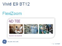 Vivid E9 BT12 FlexiZoom Feature Presentation
