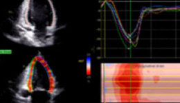 Strain Imaging: Methods, Cases and Outcomes