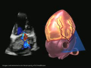 4d_color_flow_with_6-slice-imaging.jpg