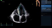 afiv2-02-roi-800px.jpg