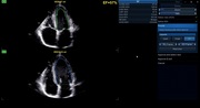 afiv2-04-modes-800px.jpg