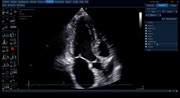 afiv2-06-viewrec-800px.jpg