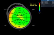 afiv2-09-bepsd.jpg