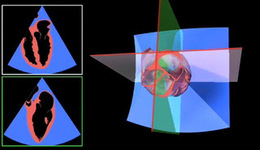 laserlines.jpg