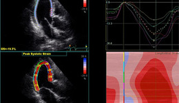 s6-aplax-q2-2.jpg