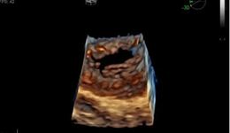 ve95-4vc-4d-mv-peds-sb42.JPG