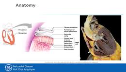 5. Pericardial Disease