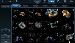 Vivid E95, E90 and S70: Image Manager