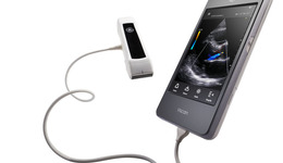 Vscan Extend User Manual