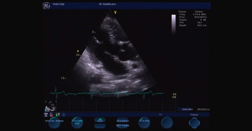 Vivid S6/S5: Basic System Operation - Image acquisition first ...