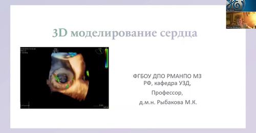 3D-моделирование сердца