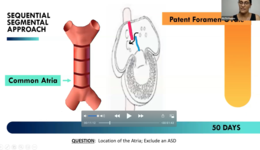 Imaging ASDs, VSDs and PDAs by Ruth Ramm