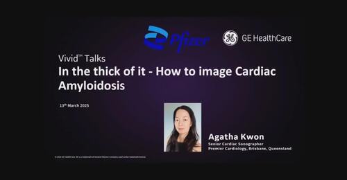 In the thick of it - How to image Cardiac Amyloidosis