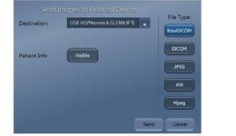 Vivid E95, E90, S70 and Vivid iq: Export DICOM AVI MPEG and ...