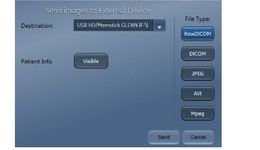 Vivid E95, E90, S70 and Vivid iq: Export DICOM AVI MPEG and JPG