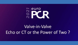 Pr Ronak Rajani & Dr Julia Grapsa @EuroPCR - Valve in Valve, echo or CT or the power of two