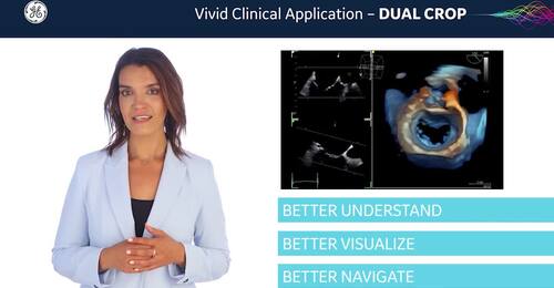Dual Crop - Vivid Clinical Application