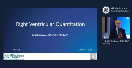 ESC 2019 - Right Ventricular Quanitification - Prof. Badano