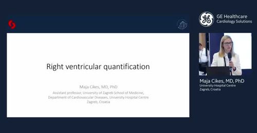 ESC 2019 - Right Ventricular Quantification - Prof. Cikes