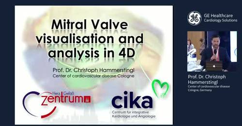 ESC 2019 - Mitral Valve visualisation and analysis in 4D - Prof. Hammerstingl