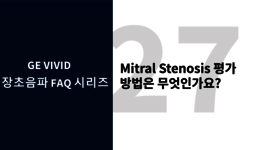 Mitral Stenosis 평가 방법은 무엇인가요?