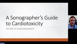 A Sonographers Guide to Cardiotoxicity