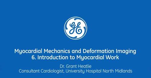 Introduction to Myocardial Work