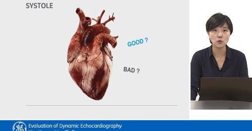2. Systolic, diastolic function 