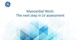 Webinar: Myocardial Work in the Left Ventricle with Prof. ...