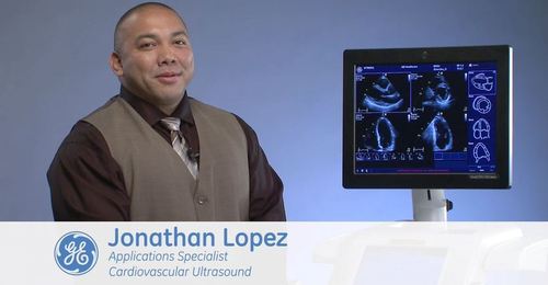 Vivid E9: A Step-by-step Approach to Performing Stress Echo