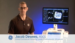 Vivid E95: Flexi-slice, Multi-slice and Laser Lines