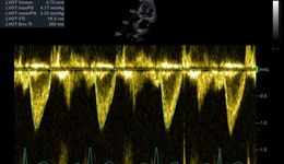 Cardiac Auto Doppler White Paper
