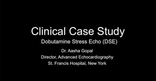 CVUS Tech Expo: Dobutamine Stress Echo with Dr. Aasha Gopal