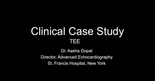 CVUS Tech Expo: TEE Case with Dr. Aasha Gopal