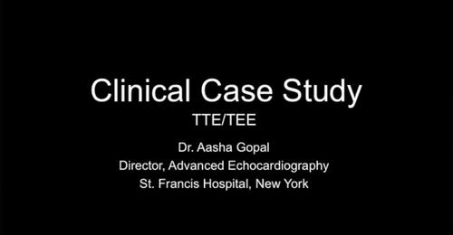 CVUS Tech Expo: TTE/TEE Clinical Case with Dr. Aasha Gopal