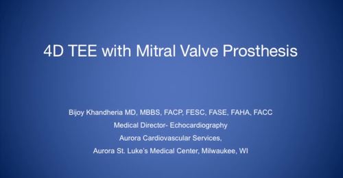 CVUS Tech Expo: 4D TEE with MV Prosthesis with Dr. Bijoy ...