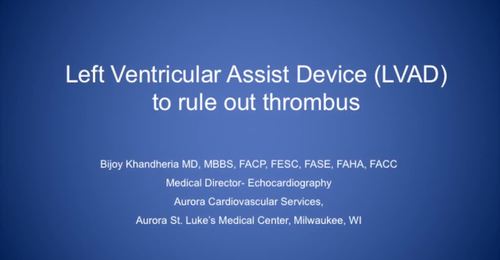 CVUS Tech Expo: LVAD to Rule Out Thrombus with Dr. Bijoy Khandheria