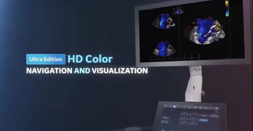 Role of 4D Transthoracic Echocardiogram in Congenital Heart ...